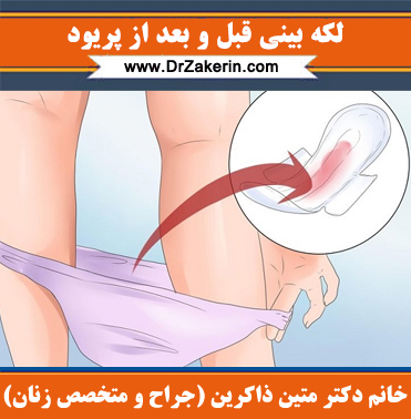لکه بینی قبل و بعد از پریود